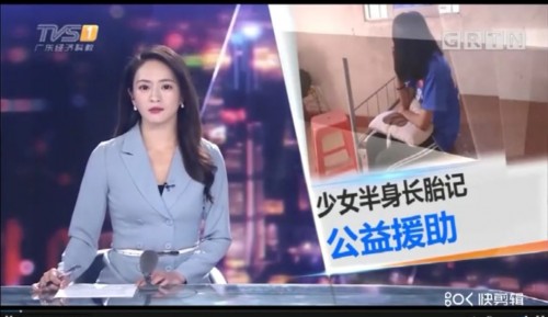 帶著“紅色面具”的女孩，公益的暖陽讓她再次起舞