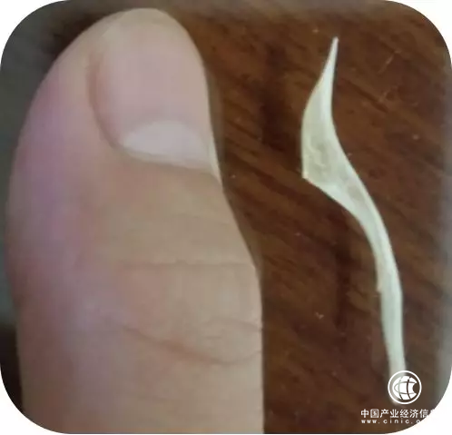 拂痛的妙手——難忘在山東醫專附屬醫院耳鼻喉科的一次診治