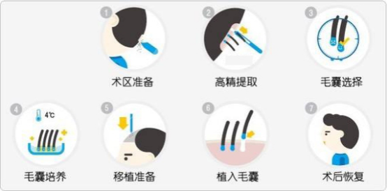 南通新生3D植發技術受國際贊譽 赴國外植發沒有必要