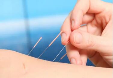 張伯禮、劉保延談針灸治療納入最新“新冠診療方案”