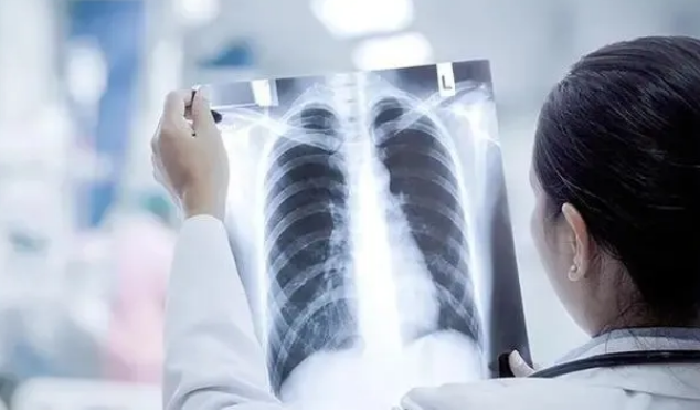 什么是“白肺”？如何避免新冠感染出現肺炎？——國家衛健委組織權威專家解答防疫熱點問題