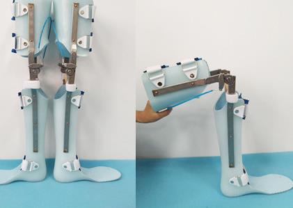 規范踝足矯形器應用 腦卒中康復有了“國家標準”