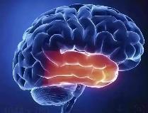 新型生物活性材料 有助缺血性腦卒中損傷修復