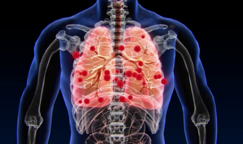 春節臨近如何防治呼吸道疾病？專家詳細解讀注意事項