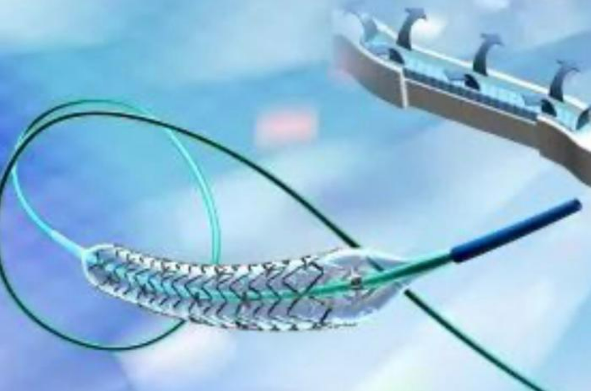 從心臟支架“打折到腳踝”看集采降價不降質