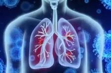 “阻擊”慢阻肺病 中國構筑呼吸健康新防線