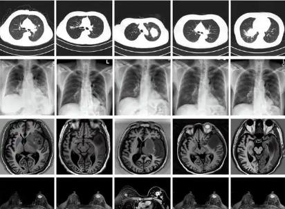 我國科學家建立生成式模型為醫學AI訓練提供技術支持