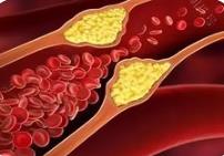 研究發現納米機器人可清除血栓