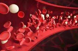 75%的成年血友病患者存在“靶關節”問題，專家建議突破醫保 “出血才可報銷”限制