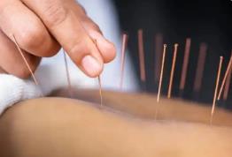 中醫藥在海外“出圈”了