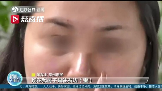 女子在蘇州美萊美容醫院隆鼻 術后卻成歪鼻子